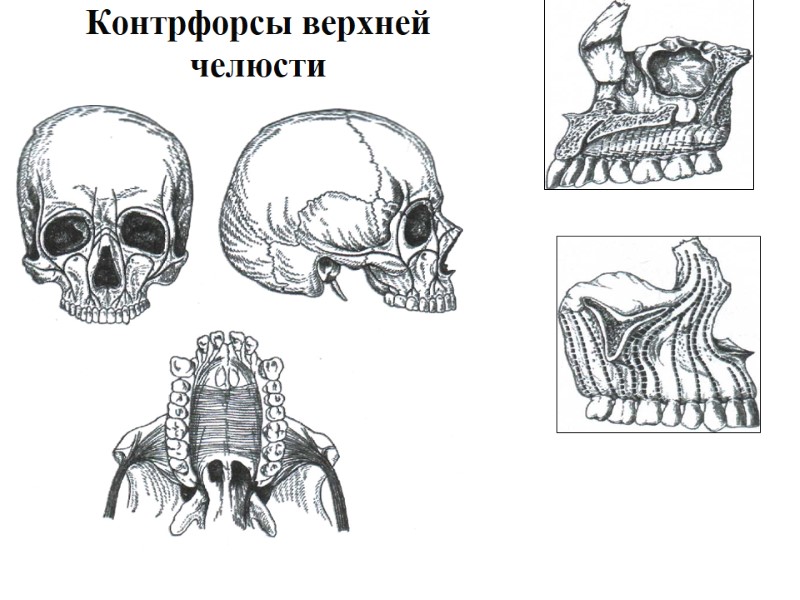 Контрфорсы верхней челюсти